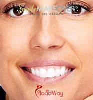 Slider image (4) Smile Makeover Playa Del Carmen